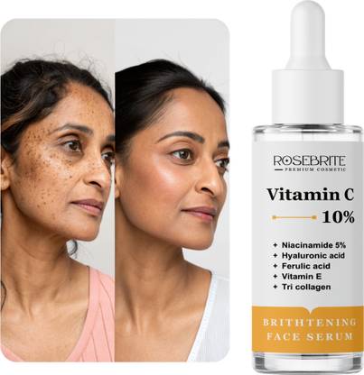 RoseBrite Daily Glow Serum – Vitamin C & Niacinamide Work Together to Brighten, Firm & Clear Skin