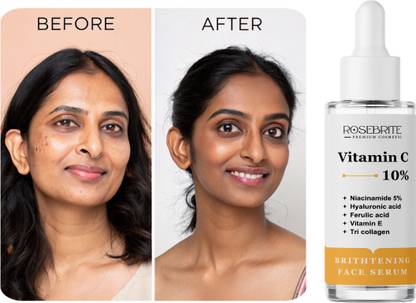 RoseBrite Vitamin C Serum – Visibly Reduces Fine Lines & Promotes Silky, Smooth, Youthful Skin with Daily Application