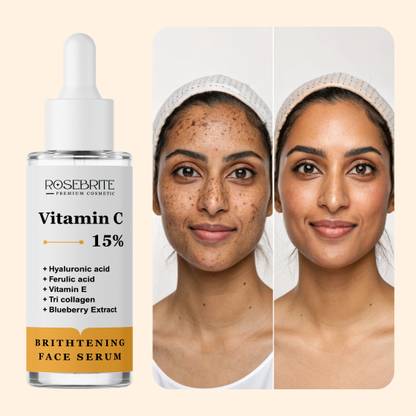 RoseBrite Daily Vitamin C Serum – Brightens Complexion & Fights Early Aging Signs