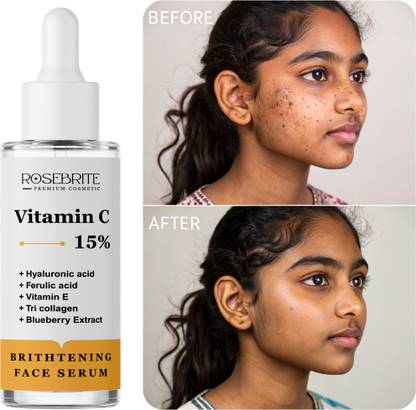 RoseBrite All-in-One Face Serum – With Vitamin C & Hyaluronic Acid to Boost Glow & Hydration