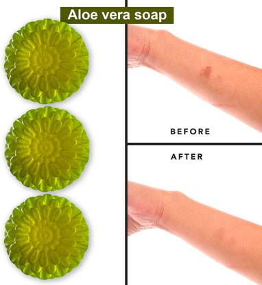 CHITAKSH Aloe Vera Soap with Green Tea Extract (100GM) (PACK OF 3)