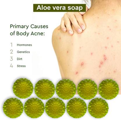 CHITAKSH Nourishing Aloe Vera Soap (100GM) (PACK OF 10)