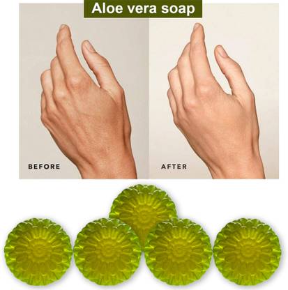CHITAKSH Aloe Vera Luxury Bathing Soap (100GM) (PACK OF 5)