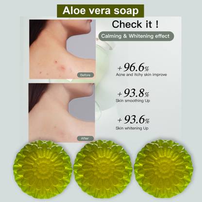 CHITAKSH Aloe Vera Soap for Sensitive Skin (100GM) (PACK OF 3)