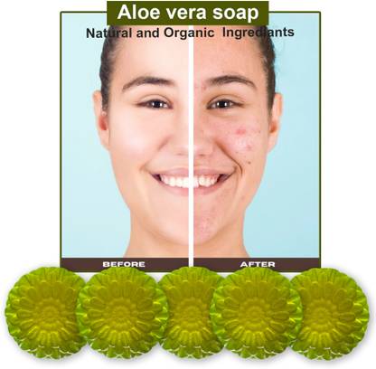 CHITAKSH Aloe Vera Rich Bathing Soap (100GM) (PACK OF 5)