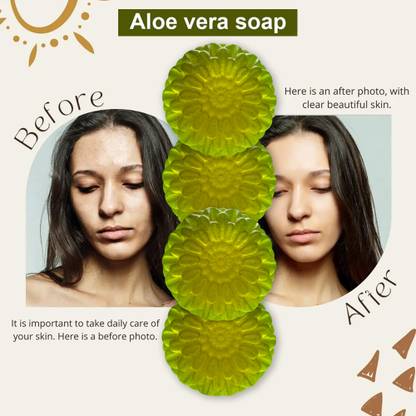 CHITAKSH Deep Cleansing Aloe Vera Soap for a Refreshing Bath (100GM) (PACK OF 4)