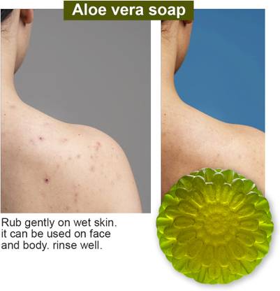 CHITAKSH Soothing Aloe Vera Soap for Dry and Itchy Skin