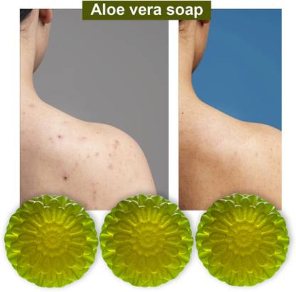 TERIHAR Aloe Vera Soap with Orange Essential Oil (100GM) (PACK OF 3)