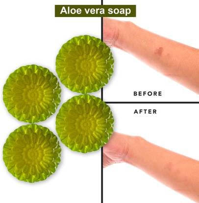 CHITAKSH Aloe Vera Soap with Tea Tree Oil for Blemish Control (100GM) (PACK OF 4)