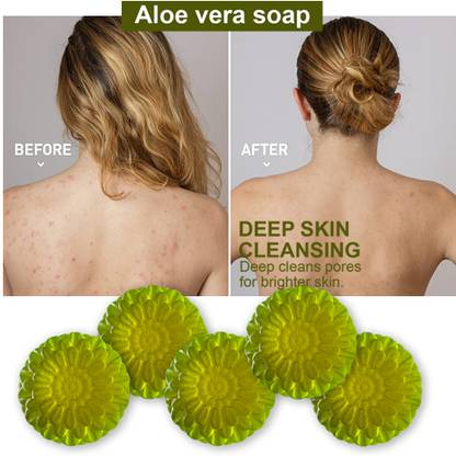 CHITAKSH Aloe Vera Clean Bathing Soap (100GM) (PACK OF 5)