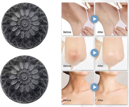 CHITAKSH Say goodbye to blemishes with activated charcoal soap