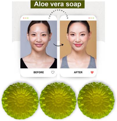 Groovy Aloe Vera Soap with Aloevera Gel (100GM) (PACK OF 3)