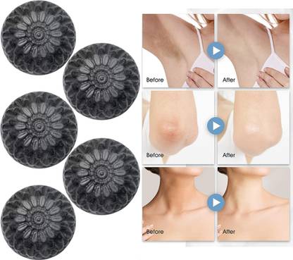 CHITAKSH Clear acne and impurities with our charcoal soap