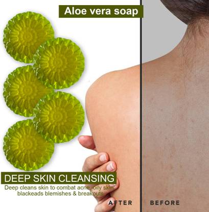 Groovy Aloe Vera Replenishing Bathing Soap (100GM) (PACK OF 5)