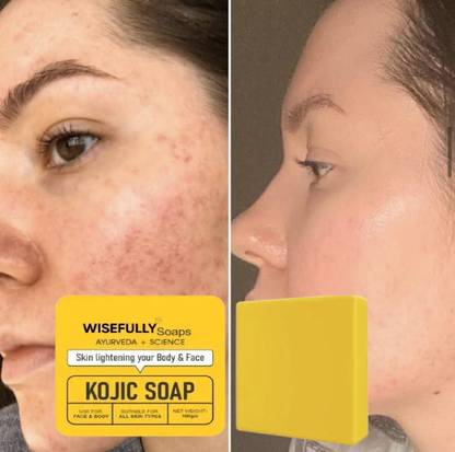 Wisefully Jiore Skincare Sinche Soap Kojic Soap Helps Achieve Even Skin Tone and Clarity