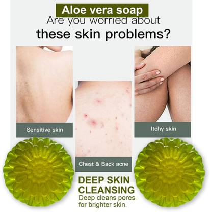 CHITAKSH Refreshing Aloe Vera Soap (100GM) (PACK OF 2)