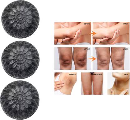 CHITAKSH Activated charcoal soap for a fresh and radiant complexion