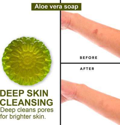 CHITAX Aloe Vera Soap for Acne-Prone Skin