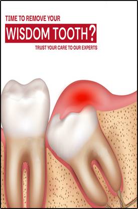 Emo 48.24 cm Dental hospital tooth wisdom care wall poster 13x19 inc Self Adhesive Sticker
