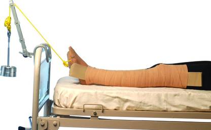 VISSCO FOOT / SKIN TRACTION KIT Supporter