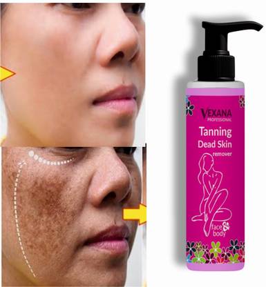 vexana TANNING AND DEAD SKIIN REMOVER 100ML 100 Tanning Liquid