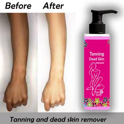 Rosevely Sun tanning remover and dead skin remover 100 Tanning Liquid