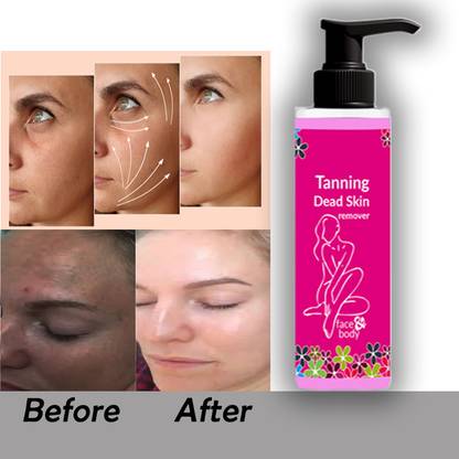 Rosevely TAN REMOVING GEL | Dark spots and dead skin removel 100 Tanning Liquid