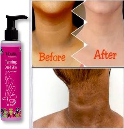 vexana TANING AND DEAD SKIN REMOVER 100ML 100 Tanning Liquid