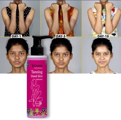 vexana D Ten Dead Skin Gel For Tanning Removal & This is best skin Remover 100 Tanning Liquid