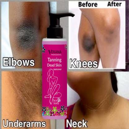 vexana Tanning Dead Skin Removal Gel For Tanning Removal & This is best skin Remover 100 Tanning Liquid