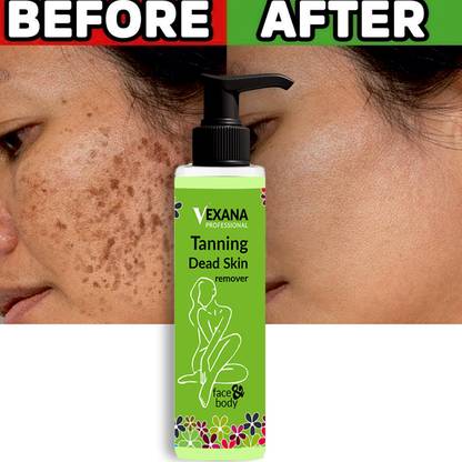 vexana Tanning dead skin remover made with Aloe-Vera & Rosemary Extract 100 Tanning Liquid