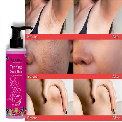 vexana TANNING AND DEAD Removal Gel For Tanning Removal 100 Tanning Liquid