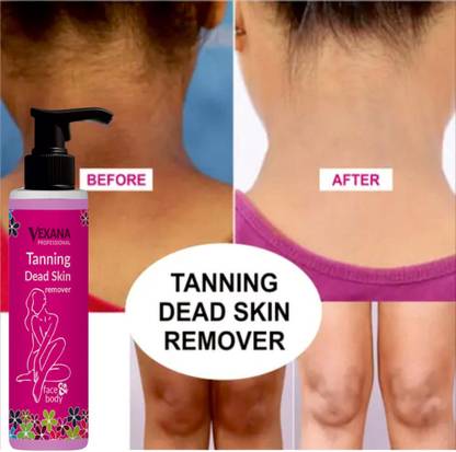 vexana Tanning Dead Skin Remover Gel & Special Natural Anti D Tan (100 ml) 100 Tanning Liquid