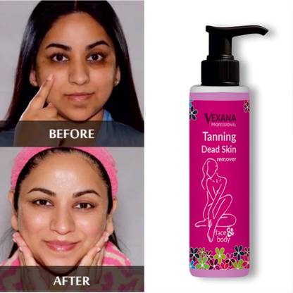 vexana Tanning And Dead Skin Remover Natural Anti Tan & Dead skin Remover 100 Tanning Liquid