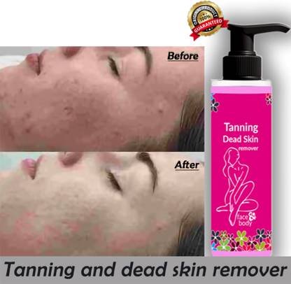 Rosevely removing dead skin and removing dull, dry skin layers 100 Tanning Liquid