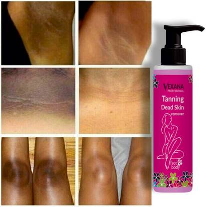 vexana Dead Tanning remover Natural anti tan & dead Skin remover 100 Tanning Liquid