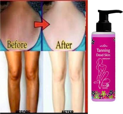 wildx Dead Skin Removal Tanning Gel For Women And Men - 100ml 100 Tanning Liquid
