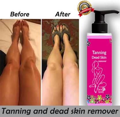 Rosevely 10X FAST TAN REMOVER | DEAD SKIN AND TANNING REMOVER 100 Tanning Liquid