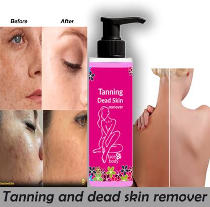 Rosevely removing dead skin cells and debris| tanning removel gel 100 Tanning Liquid
