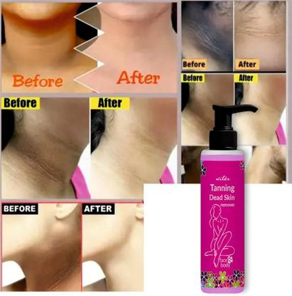 wildx Dead Skin Cells Can Help Reveal Smoother And Softer Skin 100 Tanning Liquid