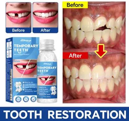 SHETZOI Tooth Repair Kit Teeth Replacement Kit for Temporary Restoration of Missing_03 Teeth Whitening Kit