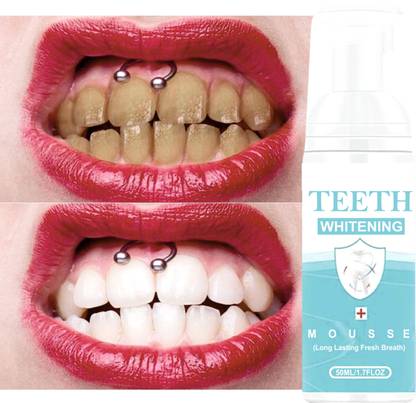 Sandarbh Toothpaste Whitening for teeth .teeth whitening and tartar remover Toothpaste - mint