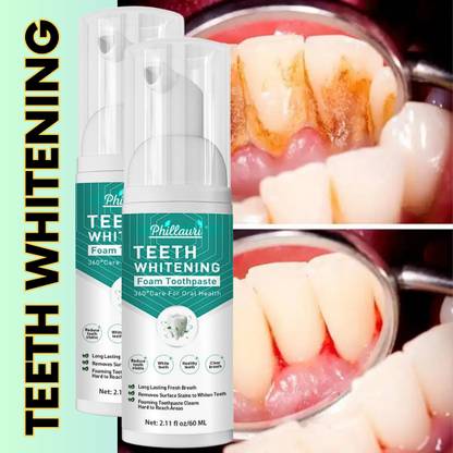 Phillauri Teeth Whitening Liquid To Removes Bad Breath and Fights Germs Teeth Whitening Kit