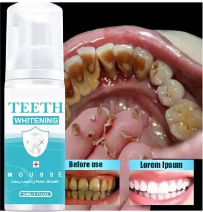 Prifakt Whitening toothpaste to remove stains, mousse, foam teeth, refreshing Teeth Whitening Kit