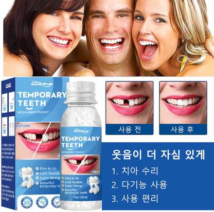 SHETZOI Tooth Repair Kit, Temporary Teeth Gap Repair Kit, TemporaryTeeth replacement Teeth Whitening Kit