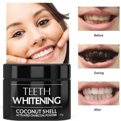 Cemera 1 Teeth Whitening Kit