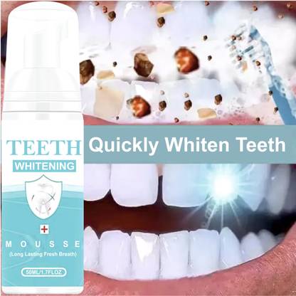 Qwera Whitening toothpaste to remove stains, mousse, foam teeth, refreshing Teeth Whitening Kit