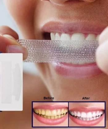 OSUFI Portable Advanced Professional Teeth Whitening Strips Teeth Whitening Kit