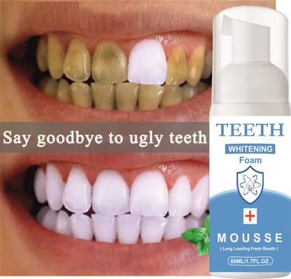 Latibule Teeth Whitening foam Make your Teeth Sparkle And White Teeth Whitening Teeth Whitening Kit