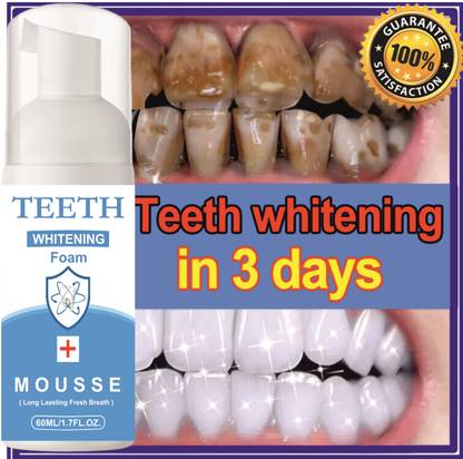Latibule Teeth Whitening Effect freshness Cold Liquid Teeth Whitening Liquid Teeth Whitening Kit
